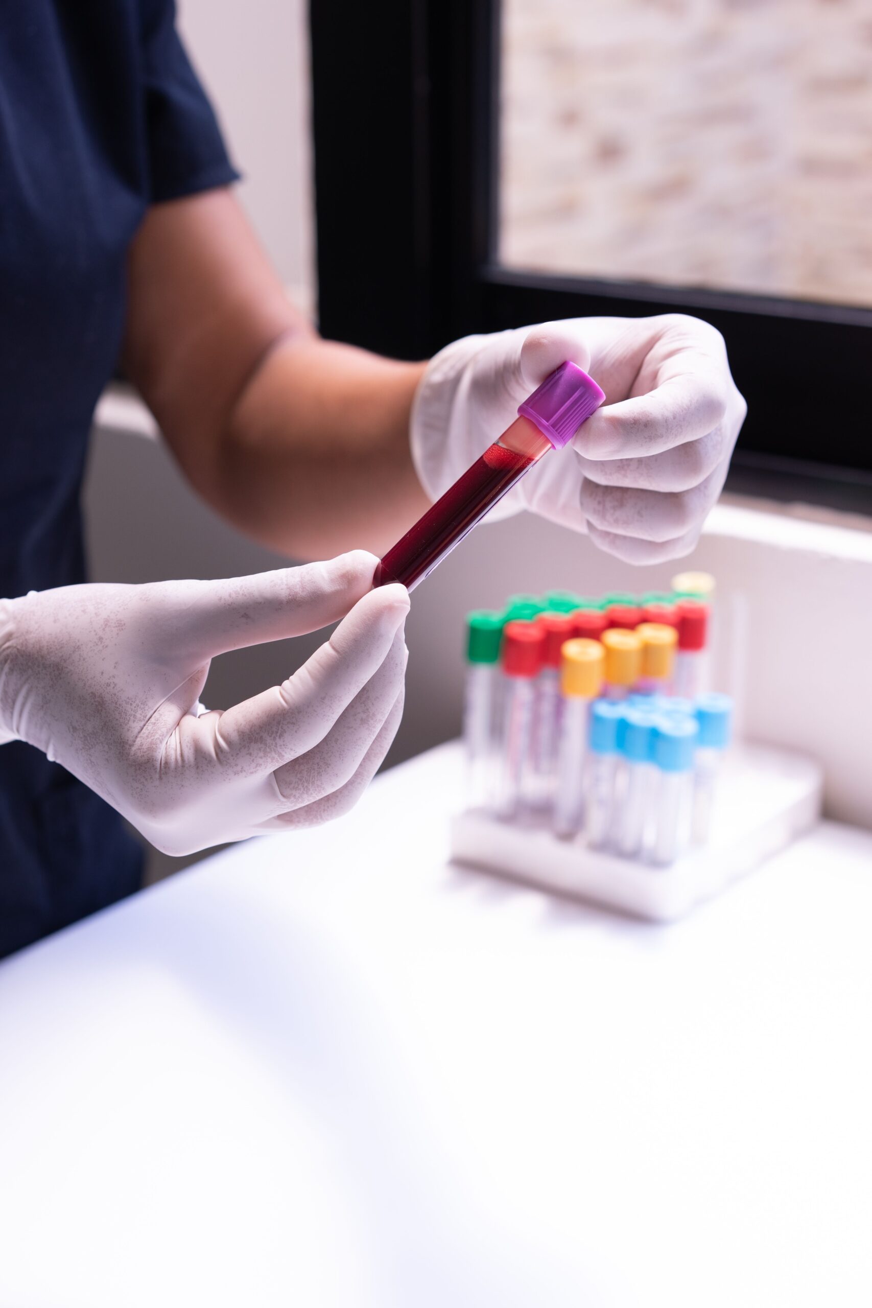 Blutprobe im Labor zur Analyse von Blutwerten und Nährstoffmängeln.